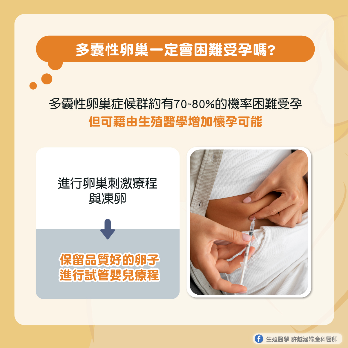 多囊性卵巢綜合症 多囊性卵巢綜合症 - 生殖醫學| 許越涵婦產科醫師