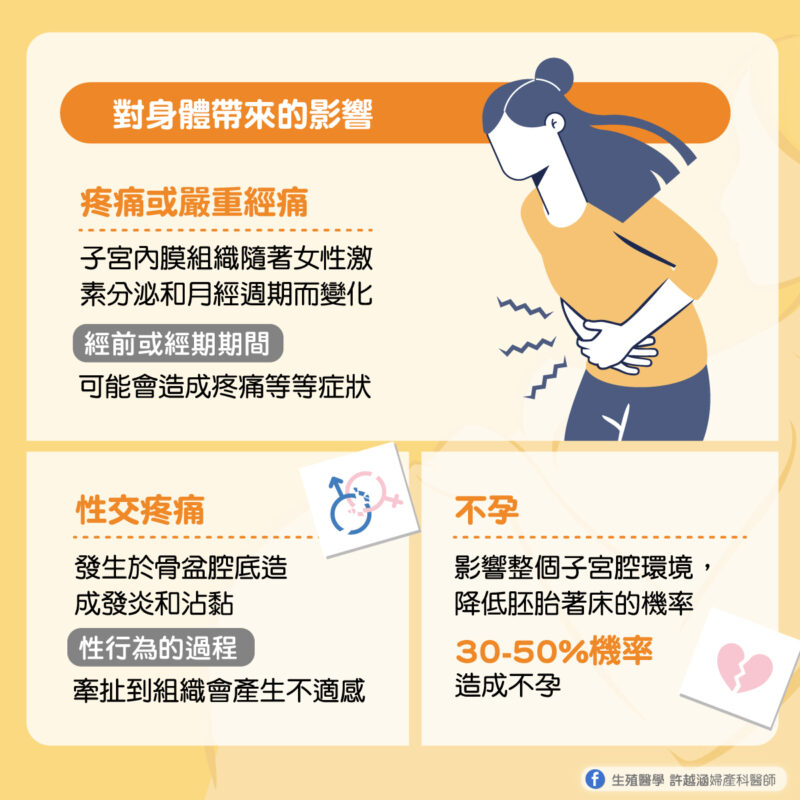 什麼是子宮內膜異位症? - 生殖醫學｜ 許越涵婦產科醫師